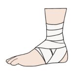 スポーツの季節ですが、ねん挫には注意を！－千歳富丘まご整骨院－