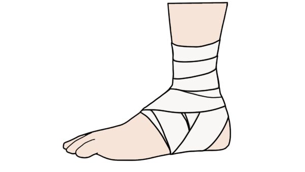スポーツの季節ですが、ねん挫には注意を！－千歳富丘まご整骨院－